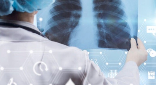 ЯК НЕ СПЛУТАТИ COVID-19 З ТУБЕРКУЛЬОЗОМ